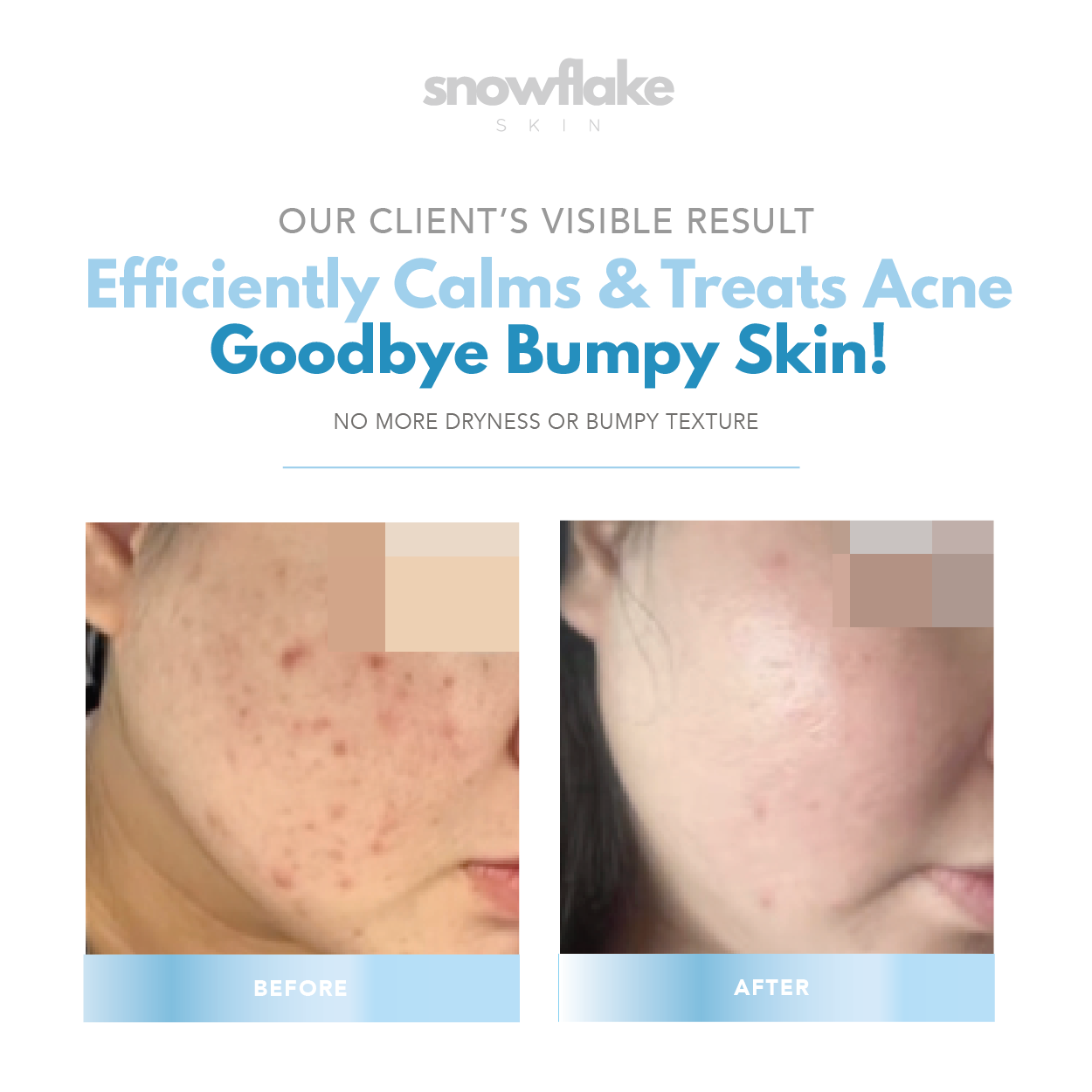 Acne Calming Cream