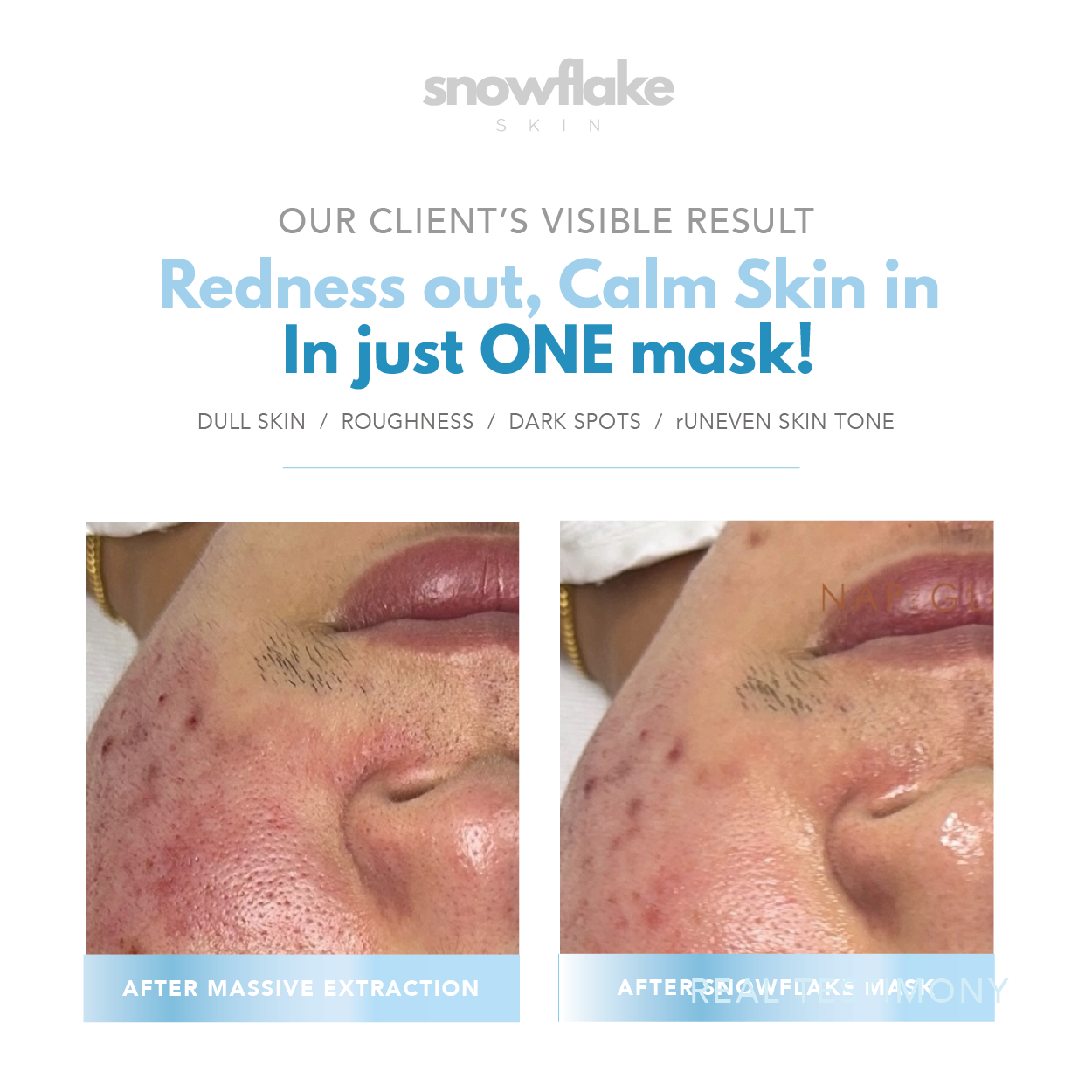 Snowflake Mask 10 pcs (1 box)
