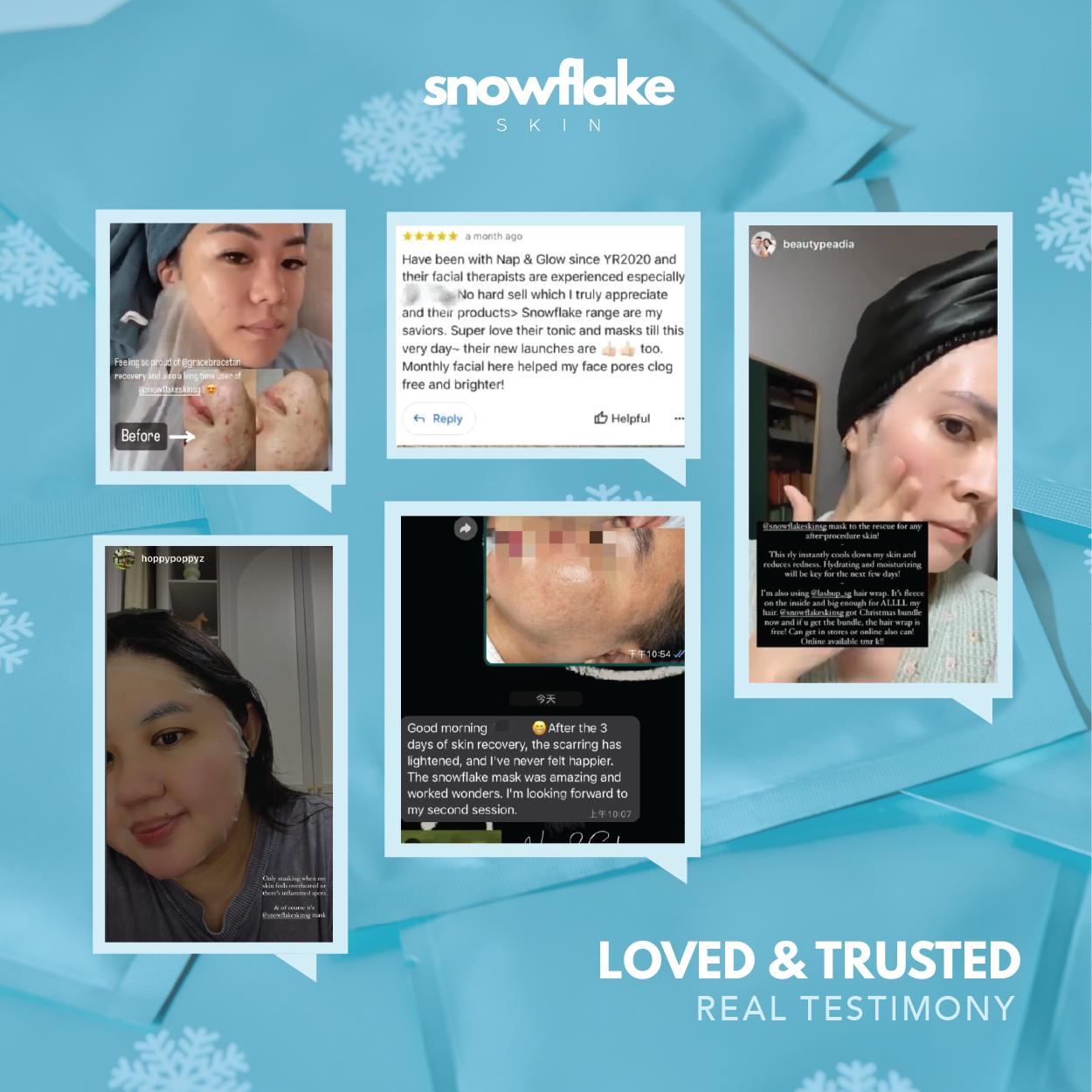 Snowflake Mask 10 pcs (1 box)