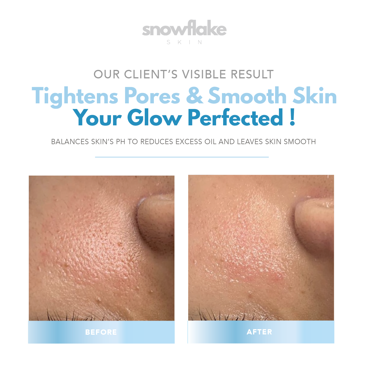 Snowflake Tonic